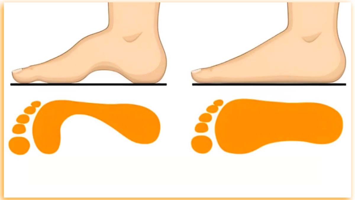 Test de personnalité : la forme de vos pieds révèle si vous êtes réaliste et extraverti !